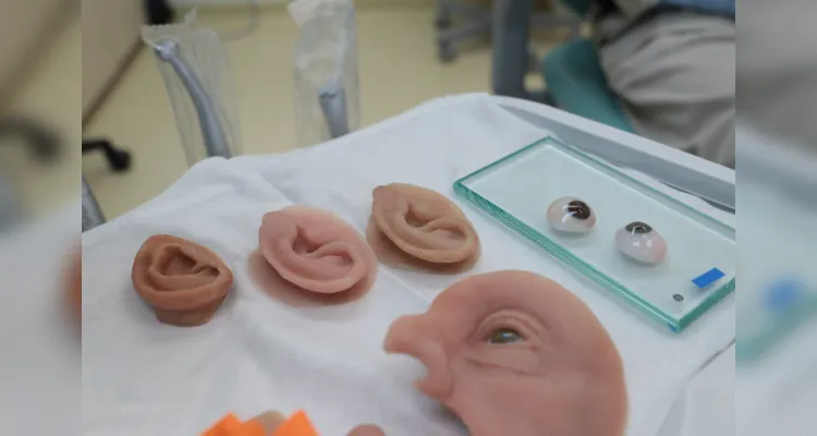 Ambulatório de próteses faciais reconstrutivas do Hospital de Reabilitação do Paraná