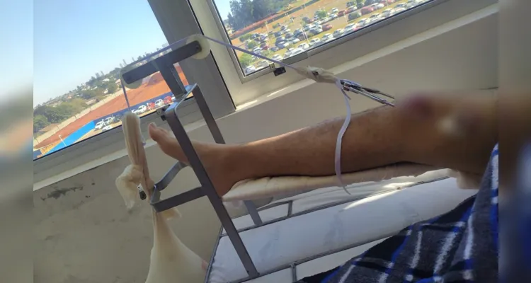 Paciente está com um 'peso' na perna, logo após a primeira cirurgia.