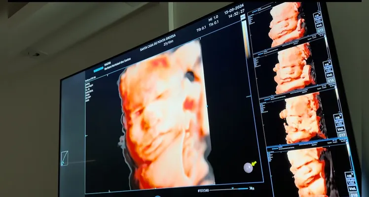 Santa Casa se consolida como hospital tecnológico em PG