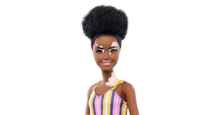 Barbie com vitiligo