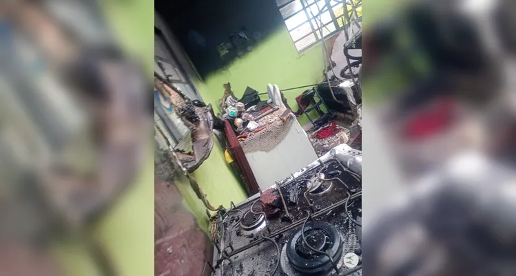 Dona de casa incendiada por ex-marido pede ajuda para recomeçar em PG