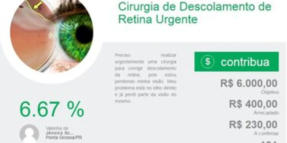 CAMPANHA DE ARRECADAÇÃO BUSCA FUNDOS PARA CIRURGIA NOS OLHOS