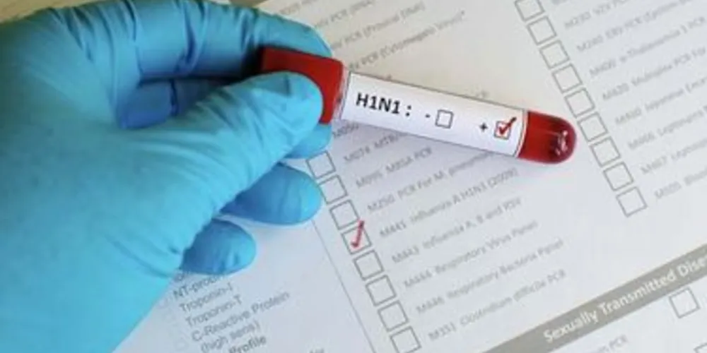 Imagem ilustrativa da imagem Regional de Saúde confirma morte por H1N1 em Rio Azul