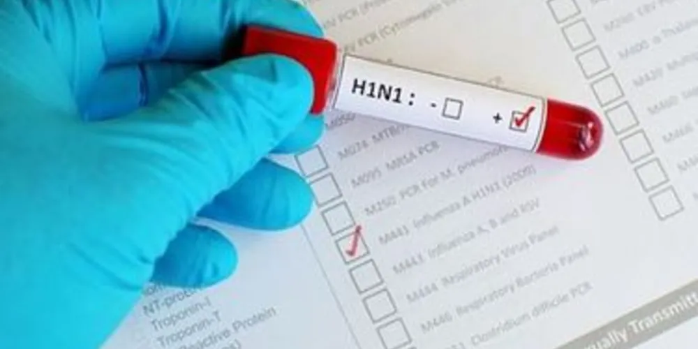 Imagem ilustrativa da imagem PG confirma primeira morte por Gripe H1N1