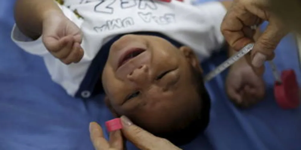 Imagem ilustrativa da imagem Risco de microcefalia em fetos varia entre 1% e 13%