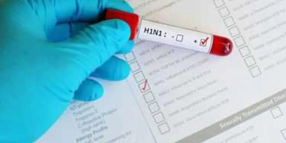 Imagem ilustrativa da imagem Menina de 19 anos morre com suspeita de H1N1 em PG