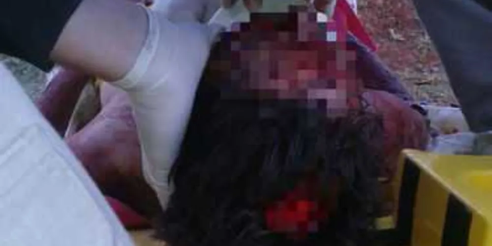 Imagem ilustrativa da imagem Idosa fica em estado grave após ataque de 9 cães