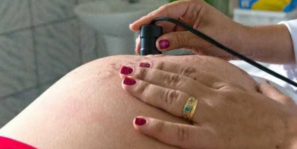 Projeto da ANS evita 10 mil cesáreas em 35 hospitais particulare