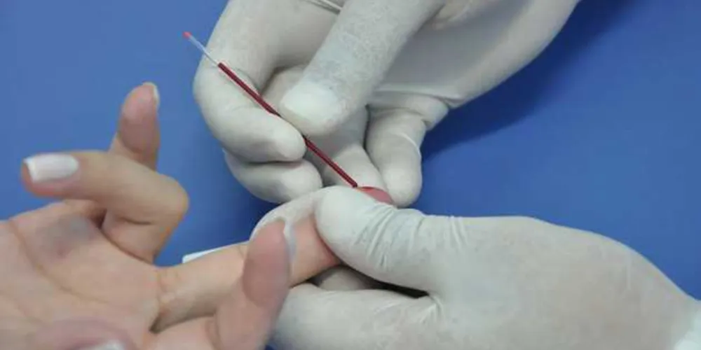 Imagem ilustrativa da imagem Saúde realiza 31 mil testes rápidos até outubro em PG