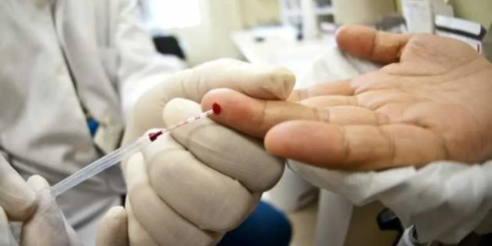 Imagem ilustrativa da imagem Brasil tem 827 mil vivendo com HIV; 112 mil não sabem que estão infectados