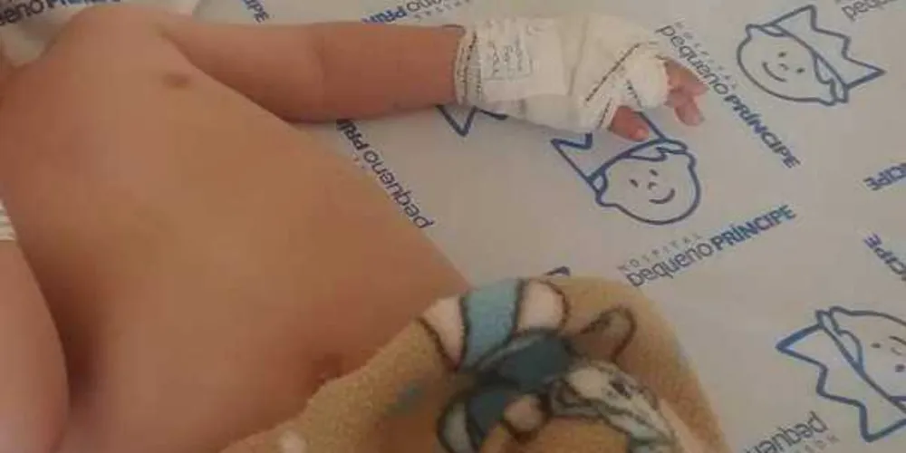 Imagem ilustrativa da imagem Bebê de 11 meses tem dedo cortado em hospital de Curitiba