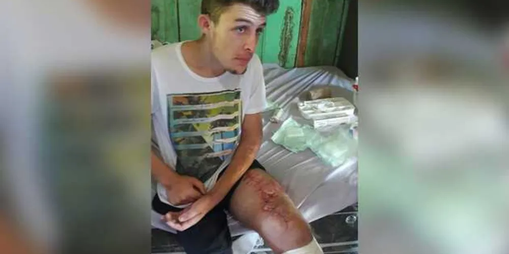 Edinei Felippe Kotula, 19 anos, se envolveu em um acidente de trânsito em dezembro