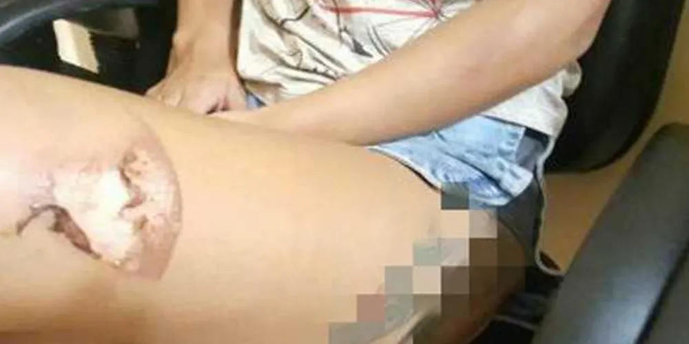 Imagem ilustrativa da imagem Homem tortura mulher com ferro de passar roupas no PR