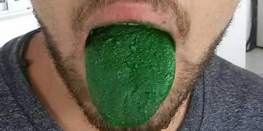 Imagem ilustrativa da imagem PRF desconfia de passageiro e descobre o motivo da cor estranha