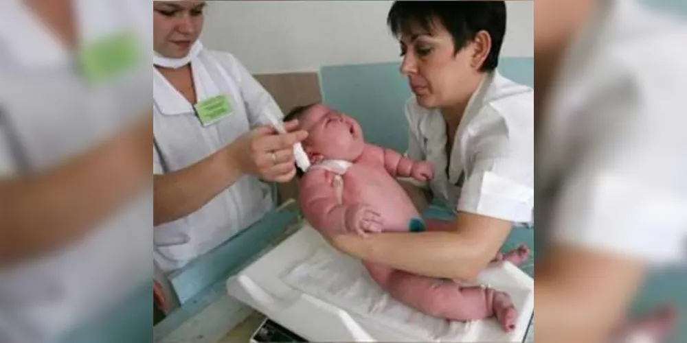Imagem ilustrativa da imagem Bebê nasce com 18 kg e bate o recorde