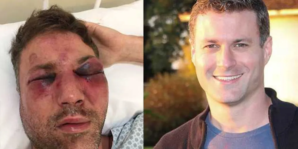 André teve várias fraturas no rosto e segue internado em um hospital de PG