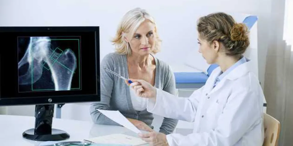 Imagem ilustrativa da imagem Osteoporose se torna mais precoce entre as mulheres