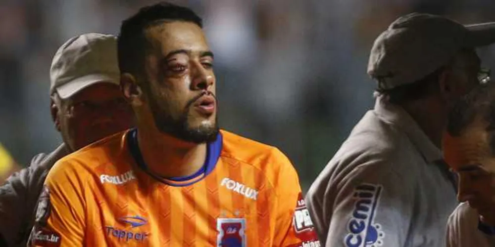 Imagem ilustrativa da imagem Atleta sofre grave fratura e desfalcará Paraná por até dois meses