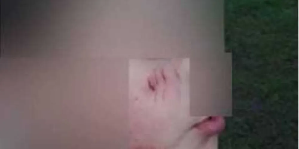 Imagem ilustrativa da imagem Criança de oito anos é atacada por cachorro de rua