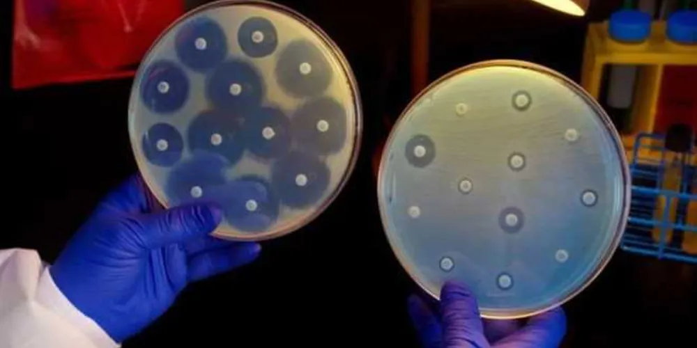 Bactérias que não respondem a antibióticos vêm aumentando a taxas alarmantes no Brasil e já são responsáveis por ao menos 23 mil mortes/ Foto: Divulgação/BBC Brasil