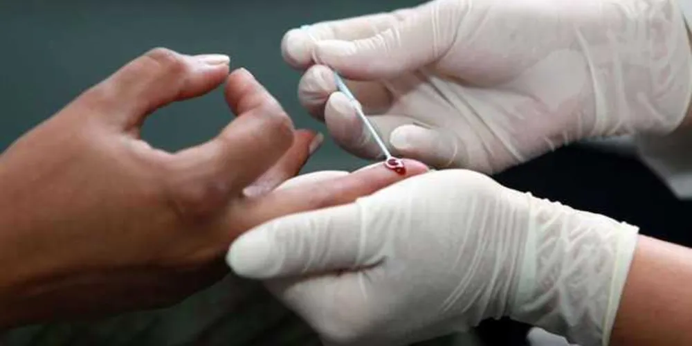 O resultado dos testes saem em alguns minutos/Foto: Fotos Públicas