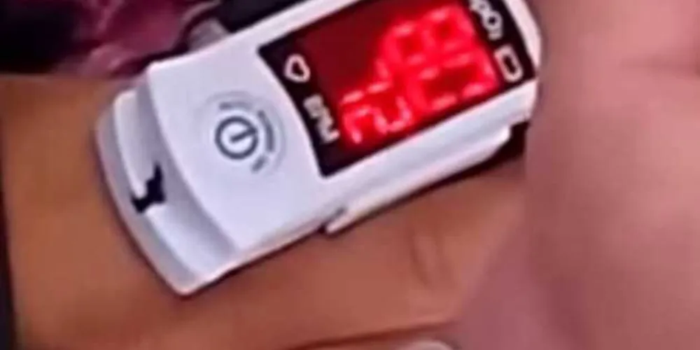 Médico usou aparelho para medir batimentos cardíacos no morto/Foto: Reprodução YouTube