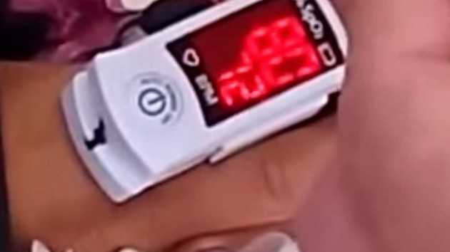 Médico usou aparelho para medir batimentos cardíacos no morto/Foto: Reprodução YouTube