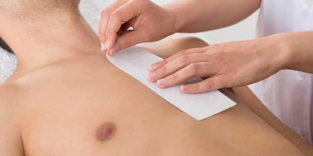 O tratamento é mais eficiente quando o pelo for grosso e bem preto, por conta da afinidade do aparelho pelo pigmento/Foto: Reprodução