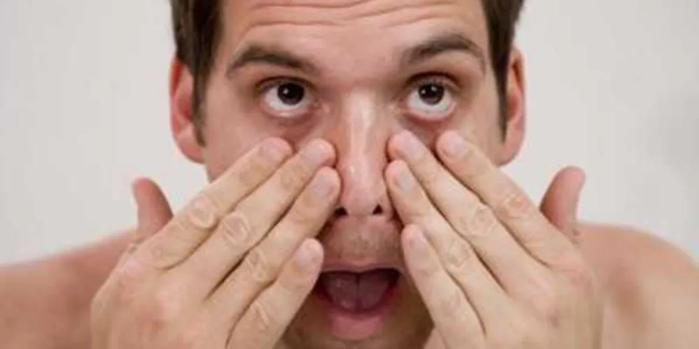 Fazer movimentos bruscos na região dos olhos podem acentuar o quadro das olheiras/Foto Reprodução