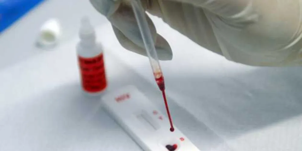 Segundo estimativas recentes baseadas em estudos populacionais, a hepatite C atinge 1,5 milhão de pessoas no Brasil e muitas delas não sabem que estão infectadas/Foto: Fotos Públicas