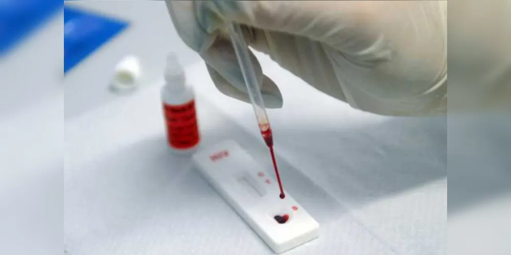 Segundo estimativas recentes baseadas em estudos populacionais, a hepatite C atinge 1,5 milhão de pessoas no Brasil e muitas delas não sabem que estão infectadas/Foto: Fotos Públicas