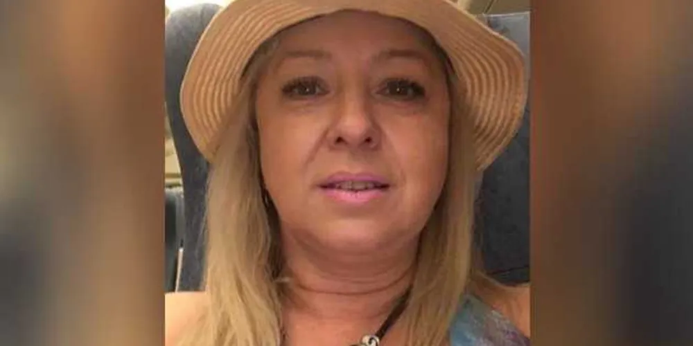 Mulher passou 18 dias internada após ter 50% do corpo queimado