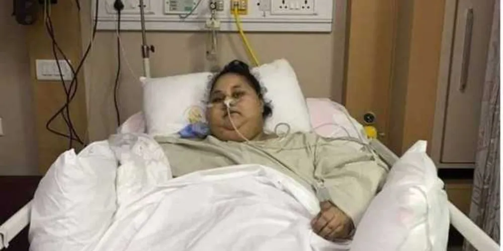 A egípcia que chegou a ser apontada recentemente como sendo a mulher mais obesa do mundo/Foto: Divulgação Saifee Hospital