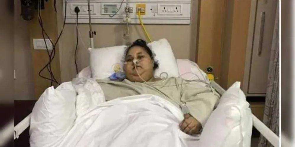 A egípcia que chegou a ser apontada recentemente como sendo a mulher mais obesa do mundo/Foto: Divulgação Saifee Hospital