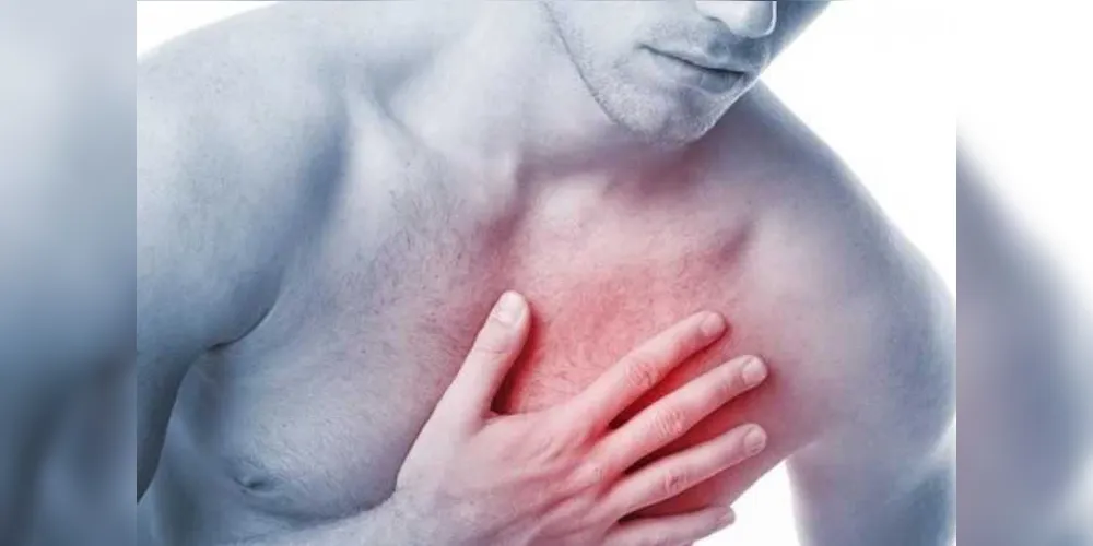 O infarto pode surgir em qualquer idade, mas ocorre com mais frequência em pessoas com mais de 45 anos e que fumam, têm excesso de peso, pressão alta, diabetes ou colesterol alto/Foto: Reprodução 