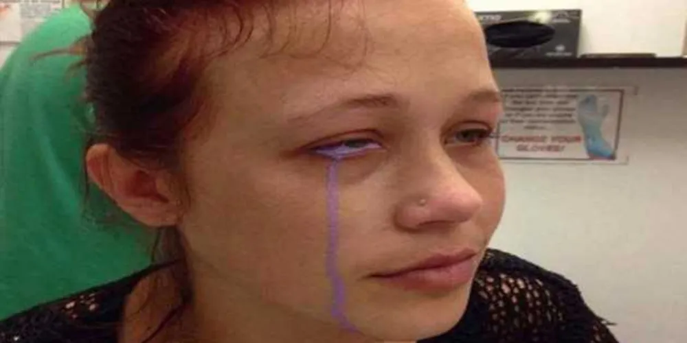 Catt Gallinger notou que havia algo de errado, quando a tinta começou a escorrer de seu olho./Foto:Divulgação Catt Gallinger