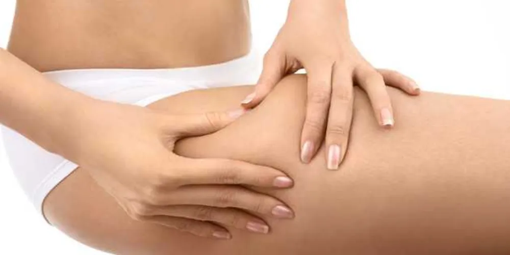 Imagem ilustrativa da imagem Atitudes simples para prevenir e tratar a celulite