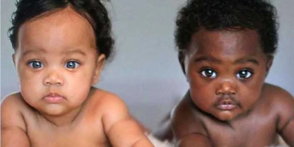 Isabella e Gabriella, gêmeas de 7 meses, são bivitelinas e fazem muito sucesso na internet