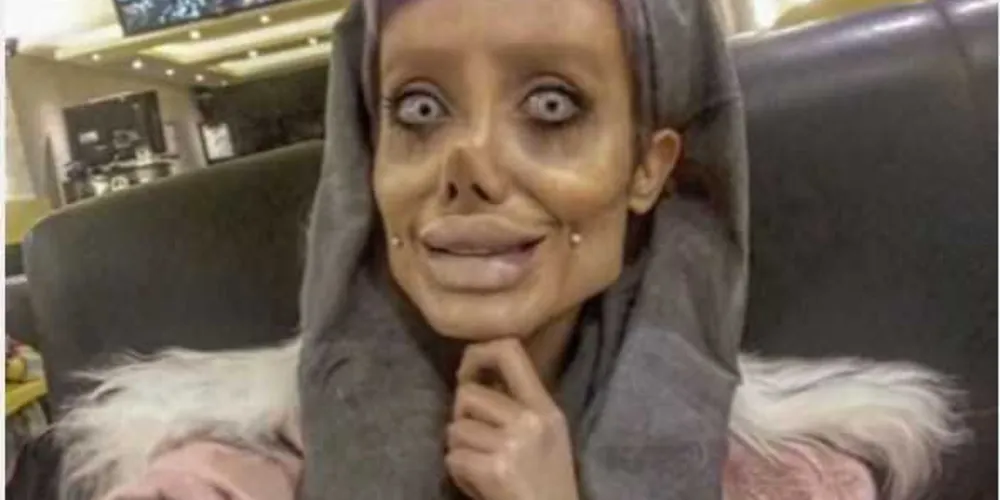 Imagem ilustrativa da imagem Iraniana faz 50 cirurgias para ficar igual a Angelina Jolie
