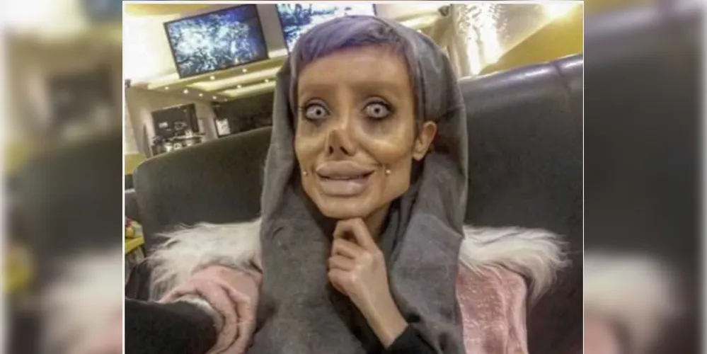 Imagem ilustrativa da imagem Iraniana faz 50 cirurgias para ficar igual a Angelina Jolie