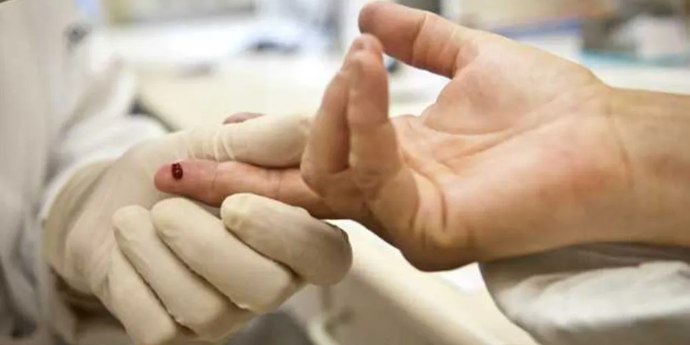 Em 2017, foi investido R$ 1,1 bilhão no tratamento de pacientes com o vírus/Foto: Arquivo Agência Brasil