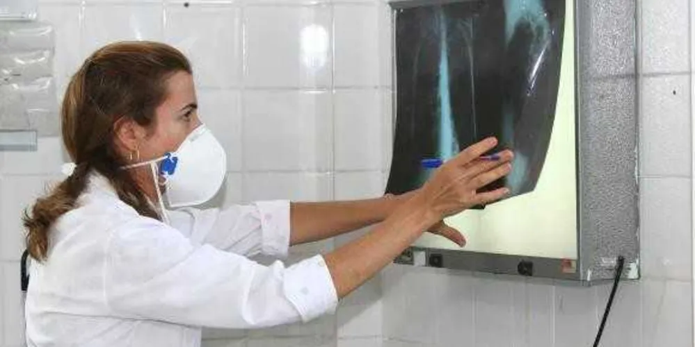 É necessário ficar atento aos sintomas da tuberculose para dar início ao tratamento e, com isso, interromper a contaminação das outras pessoas/Foto: Reprodução Agecom Bahia