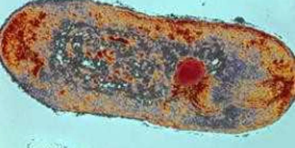 Estima-se que, no mundo, pelo menos 700 mil pessoas já morreram por resistência antimicrobiana e que um quarto desses óbitos foram por tuberculose/Foto: Reprodução Fiocruz