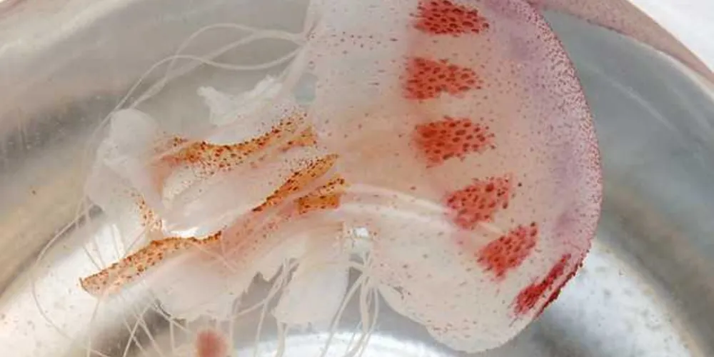 Se você sentir dor em queimação ou ardência, saia imediatamente da água, pois pode ter sofrido um acidente de contato com águas-vivas/Foto: Divulgação SESA