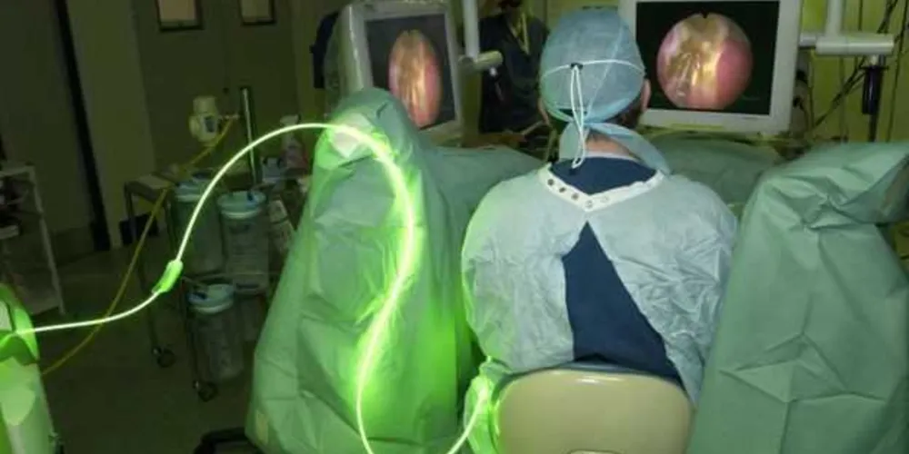 Alguns casos de hiperplasia de próstata exigem intervenção cirúrgica como a ressecção endoscópica/Foto: Reprodução Science Photo Library