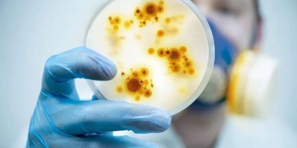 As bactérias mais resistentes são Escherichia coli, Klebsiella pneumoniae, Staphylococcus aureus, Streptococcus pneumoniae e Salmonella spp/Foto: Reprodução Thinkstock