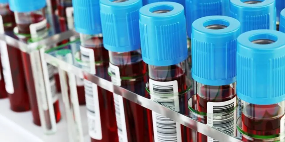 apresenta perda de memória, o que indica a perda definitiva de células cerebrais.

Acredita-se que o Alzheimer se desenvolva de vinte a trinta anos antes do aparecimento dos primeiros sintomas/Foto: Divulgação iStockphoto/Getty Images