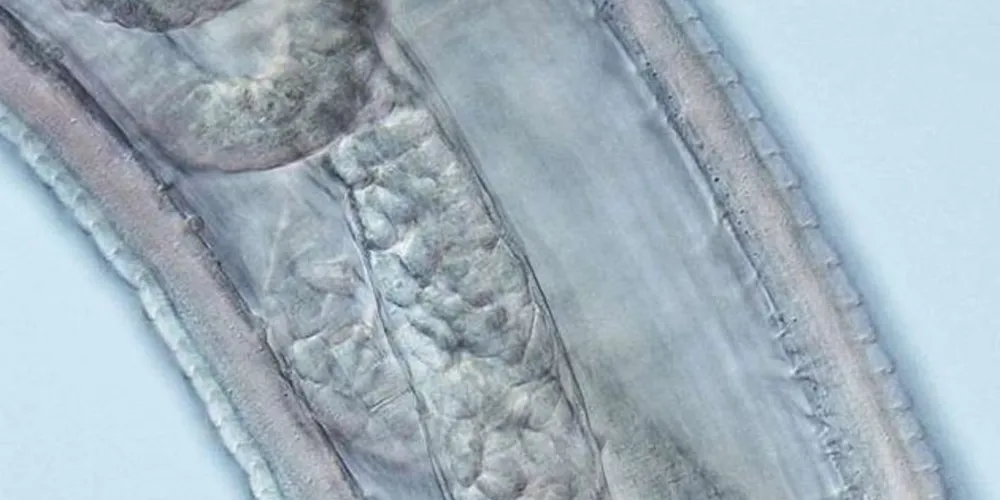 Close microscópico do verme Theçazoa gulosa que foi retirado do olho da mulher/Foto: Divulgação CDC Global