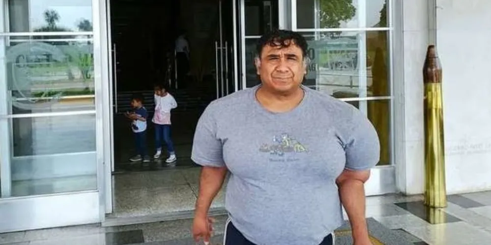 Alejandro Ramos, o 'Willy', convive com seu corpo inchado há quatro anos/Foto: Divulgação BBC Brasil 