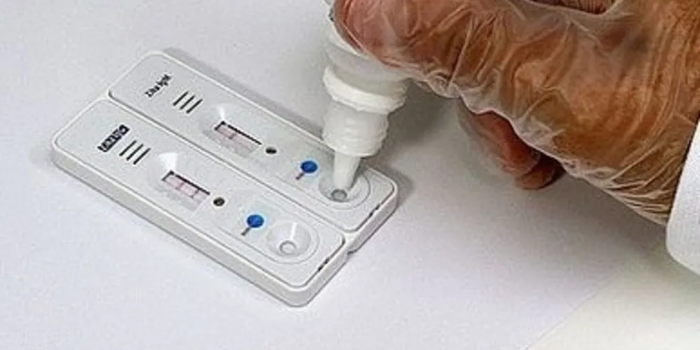O resultado do teste fica pronto em 20 minutos/Foto: Reprodução 